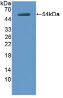 Polyclonal Antibody to Thrombomodulin (TM)