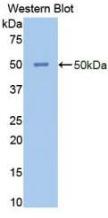 Polyclonal Antibody to Enolase, Neuron Specific (NSE)