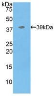 Polyclonal Antibody to Myelin Basic Protein (MBP)