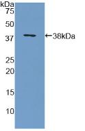 Polyclonal Antibody to Myelin Basic Protein (MBP)