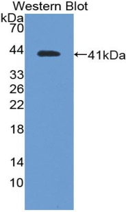 Polyclonal Antibody to Brain Natriuretic Peptide (BNP)