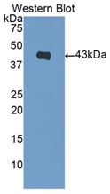 Polyclonal Antibody to Brain Natriuretic Peptide (BNP)