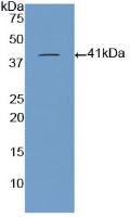 Polyclonal Antibody to Brain Natriuretic Peptide (BNP)