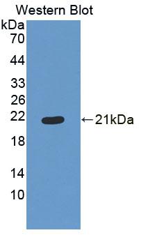 Polyclonal Antibody to Endostatin (ES)