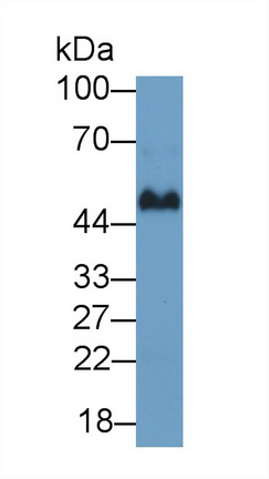 Polyclonal Antibody to Immunoglobulin G (IgG)