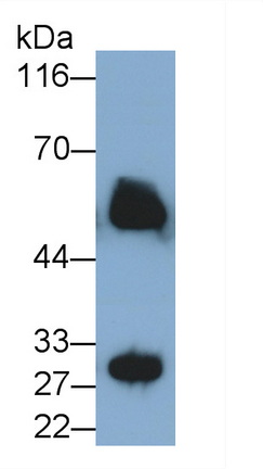 Polyclonal Antibody to Immunoglobulin G (IgG)