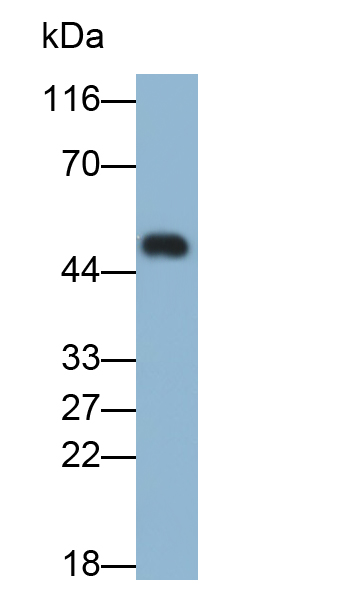 Polyclonal Antibody to Immunoglobulin E (IgE)