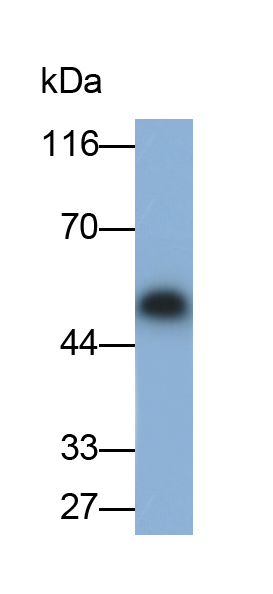 Polyclonal Antibody to Immunoglobulin A (IgA)