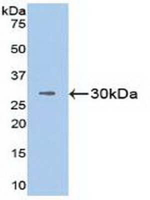 Polyclonal Antibody to Vascular Cell Adhesion Molecule 1 (VCAM1)