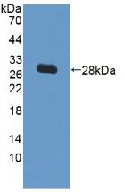 Polyclonal Antibody to Vascular Cell Adhesion Molecule 1 (VCAM1)