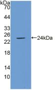 Polyclonal Antibody to Intercellular Adhesion Molecule 1 (ICAM1)