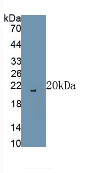 Polyclonal Antibody to Fibroblast Growth Factor 2, Basic (FGF2)