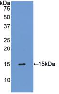 Polyclonal Antibody to Tissue Inhibitors Of Metalloproteinase 1 (TIMP1)