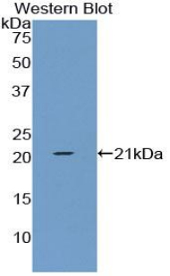 Polyclonal Antibody to Tissue Inhibitors Of Metalloproteinase 1 (TIMP1)