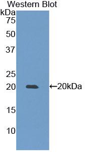 Polyclonal Antibody to Matrix Metalloproteinase 9 (MMP9)