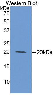 Polyclonal Antibody to Matrix Metalloproteinase 9 (MMP9)