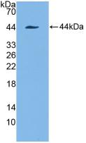 Polyclonal Antibody to Cytokeratin 7 (CK7)