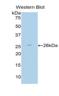 Polyclonal Antibody to Thyroid Peroxidase (TPO)