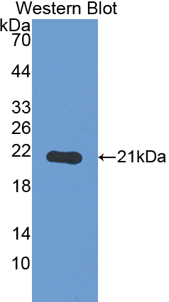 Polyclonal Antibody to Thyroid Peroxidase (TPO)