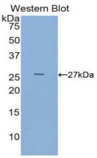 Polyclonal Antibody to Epidermal Growth Factor (EGF)