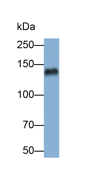 Polyclonal Antibody to Epidermal Growth Factor (EGF)