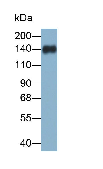 Polyclonal Antibody to Epidermal Growth Factor (EGF)