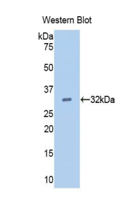 Polyclonal Antibody to Epidermal Growth Factor (EGF)