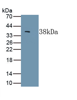 Polyclonal Antibody to Epidermal Growth Factor (EGF)