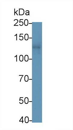 Polyclonal Antibody to Leukemia Inhibitory Factor Receptor (LIFR)