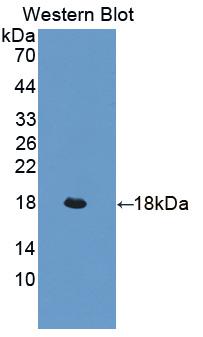 Polyclonal Antibody to Leukemia Inhibitory Factor Receptor (LIFR)