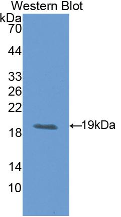 Polyclonal Antibody to Leukemia Inhibitory Factor Receptor (LIFR)