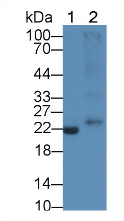 Polyclonal Antibody to Interleukin 1 Beta (IL1b)