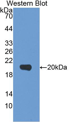 Polyclonal Antibody to Interleukin 1 Beta (IL1b)