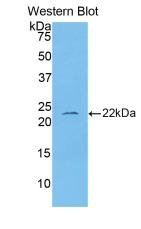 Polyclonal Antibody to Interleukin 1 Beta (IL1b)