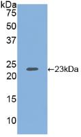 Polyclonal Antibody to Heparan Sulfate Proteoglycan (HSPG)