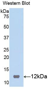 FITC-Linked Polyclonal Antibody to S100 Calcium Binding Protein B (S100B)