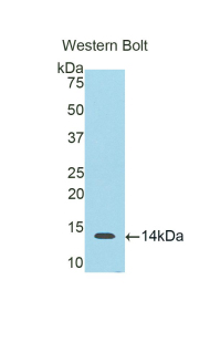 Polyclonal Antibody to S100 Calcium Binding Protein B (S100B)