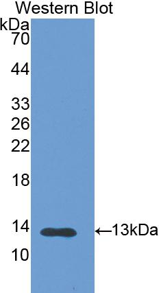 Polyclonal Antibody to S100 Calcium Binding Protein A11 (S100A11)