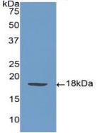 Polyclonal Antibody to P-Selectin (SELP)