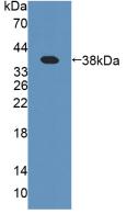 Polyclonal Antibody to Procollagen III N-Terminal Propeptide (PIIINP)