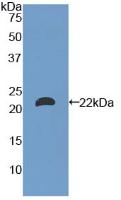 Polyclonal Antibody to Laminin Alpha 1 (LAMA1)