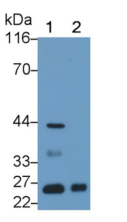 Polyclonal Antibody to Aquaporin 1 (AQP1)