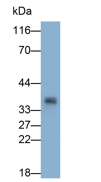 Polyclonal Antibody to Cyclin D1 (CCND1)