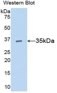 Polyclonal Antibody to Cyclin D1 (CCND1)