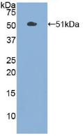 Polyclonal Antibody to Pyruvate kinase isozymes M2 (PKM2)