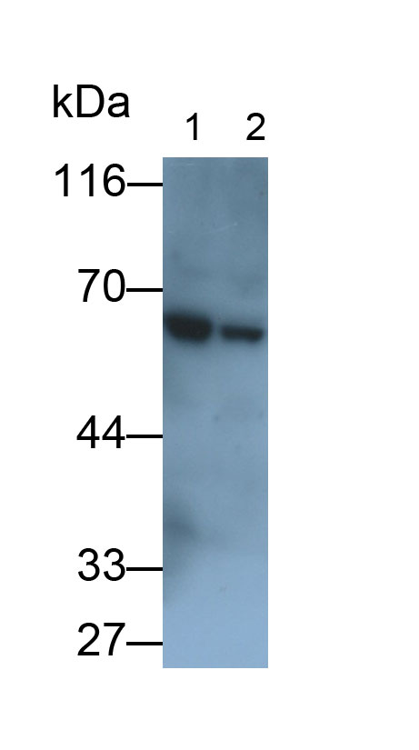 Polyclonal Antibody to Pyruvate kinase isozymes M2 (PKM2)