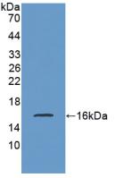 Polyclonal Antibody to Somatostatin (SST)