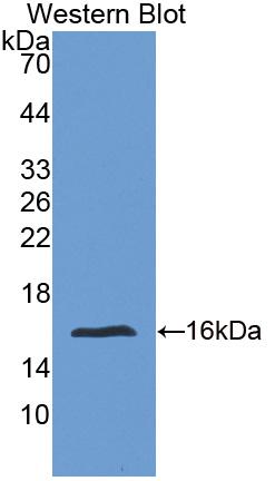 Polyclonal Antibody to Fibrillin 1 (FBN1)