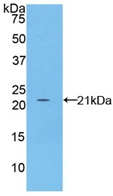 Polyclonal Antibody to Fibrillin 1 (FBN1)