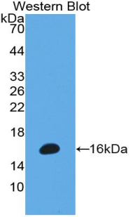 Polyclonal Antibody to Myeloperoxidase (MPO)